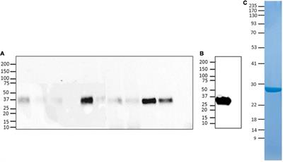 Epidemic Preparedness—Leishmania tarentolae as an Easy-to-Handle Tool to Produce Antigens for Viral Diagnosis: Application to COVID-19